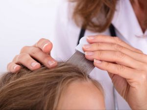 طريقة إزالة القمل من شعر الأطفال