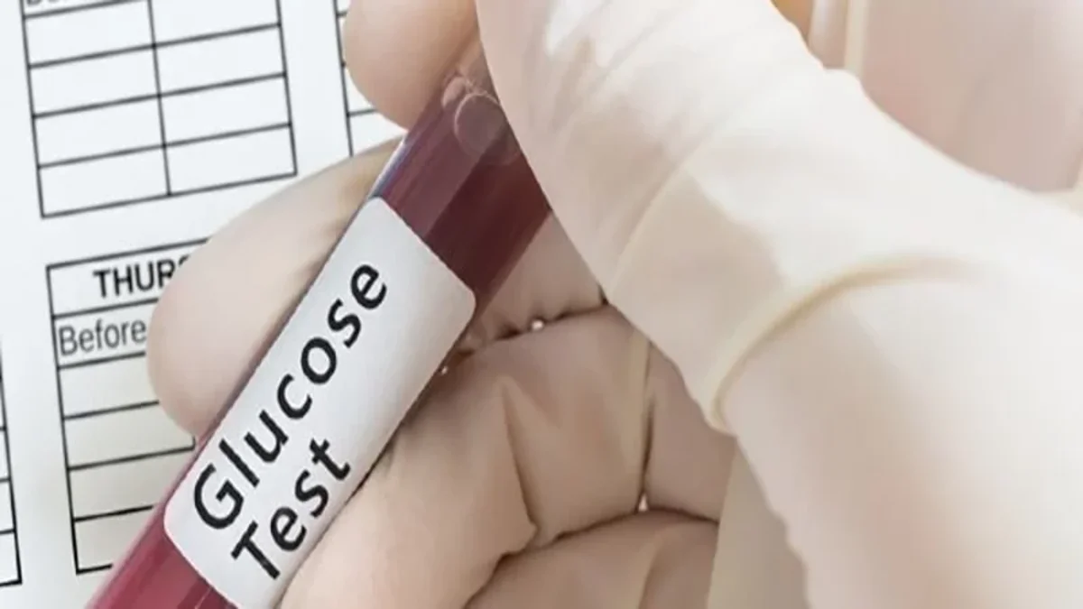 تحليل random blood glucose