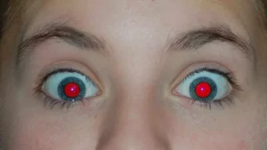 ما سبب العيون الحمراء التي تظهر في الصور؟ وكيف يمكن إصلاحها؟